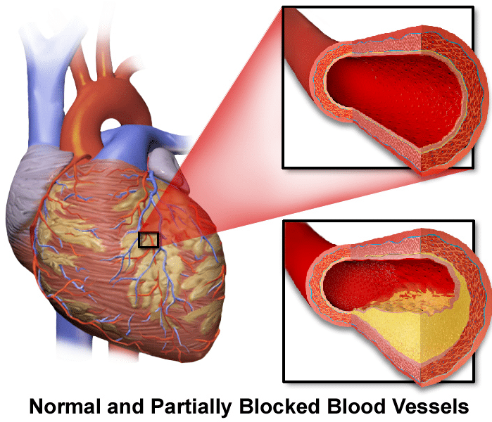 Effects of diseases and disorders on the circulatory system